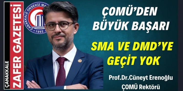 Çanakkale Onsekiz Mart Üniversitesinden Sağlıkta Büyük Atılım.! 1 sma dmd